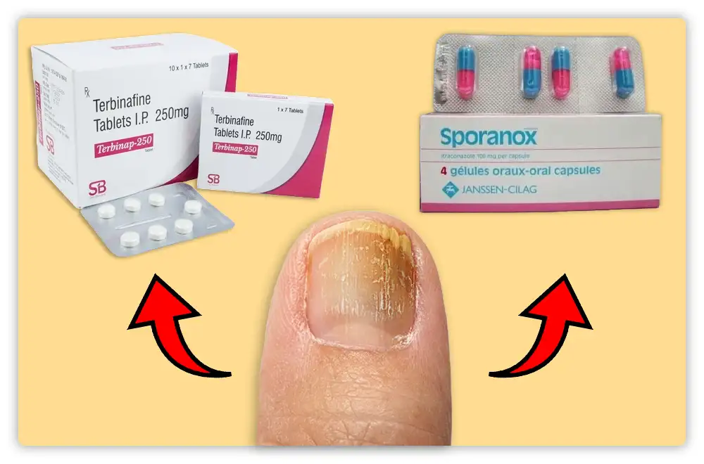 Antifungal Medications for Toenail Fungus
