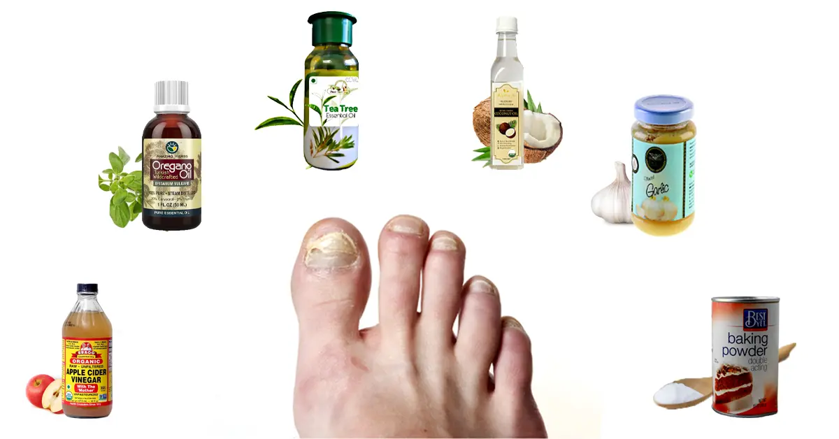 Home Remedies for Toenail Fungus
